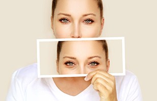 Woman holding picture of herself before lower eyelid blepharoplasty