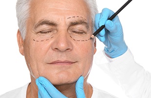 Senior man with closed eyes, preparing for blepharoplasty